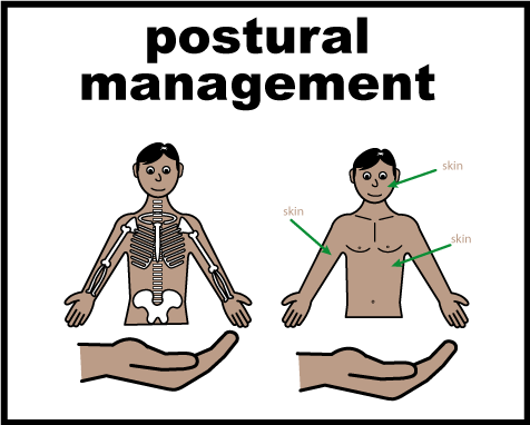 Two drawings of a person showing postural support with hands and arrows.