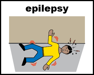 A picture showing a person having a siezure
